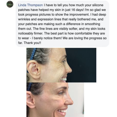Losveo™ Premium Silicone Scar Sheets for Effective Scar Reduction & Healing